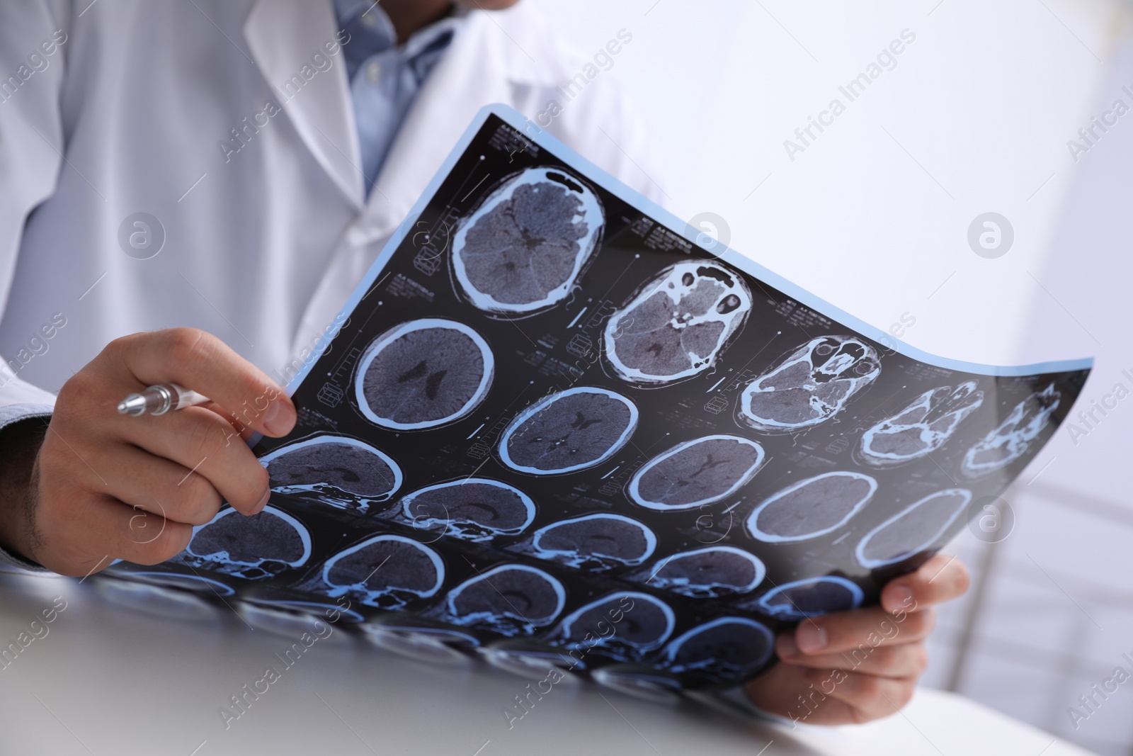Photo of Doctor examining MRI images of patient with multiple sclerosis at table in clinic, closeup