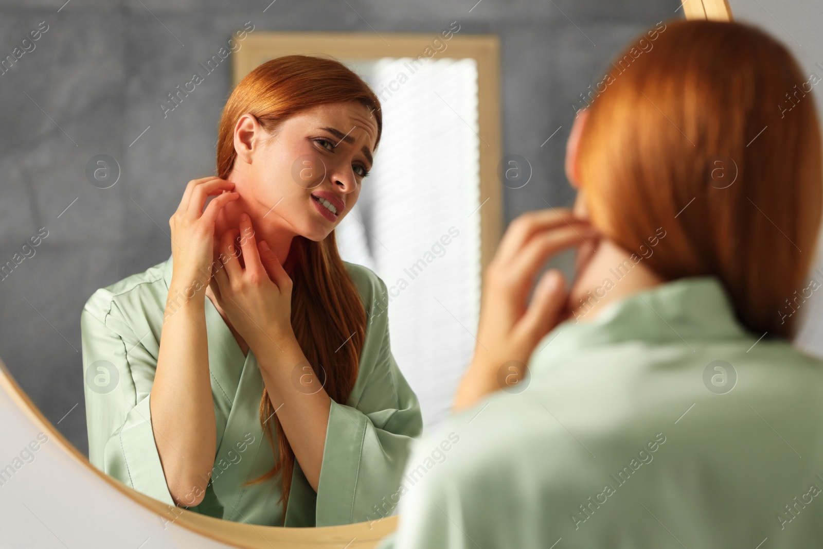 Photo of Suffering from allergy. Young woman scratching her neck near mirror in bathroom