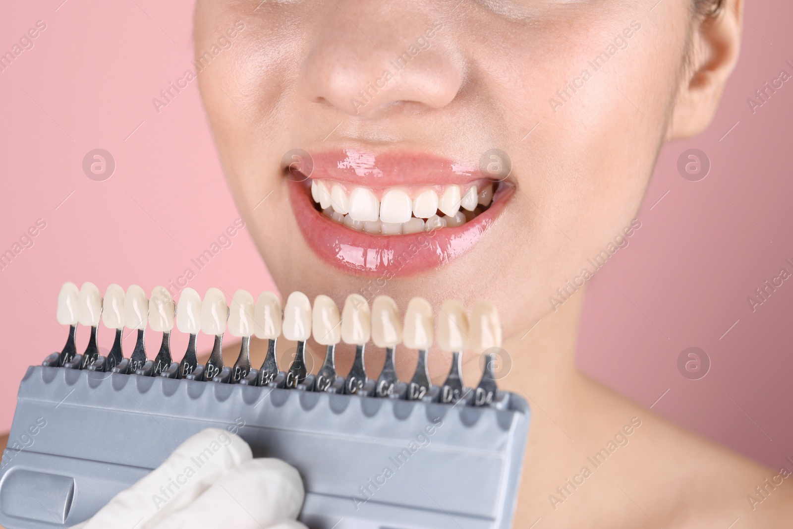 Photo of Dentist checking young woman's teeth color, closeup