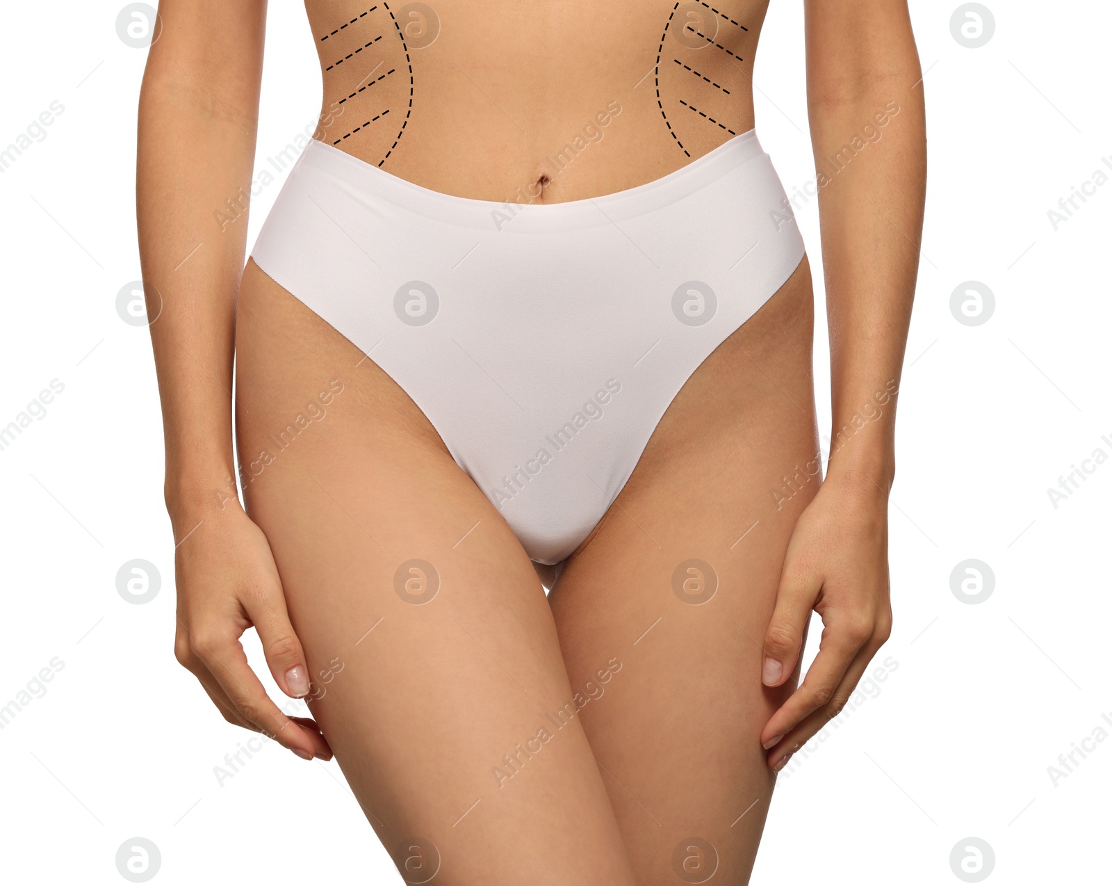 Image of Woman with markings for cosmetic surgery on her abdomen against white background, closeup