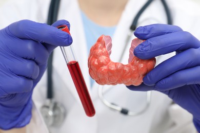 Endocrinologist showing thyroid gland model and blood sample in test tube, closeup