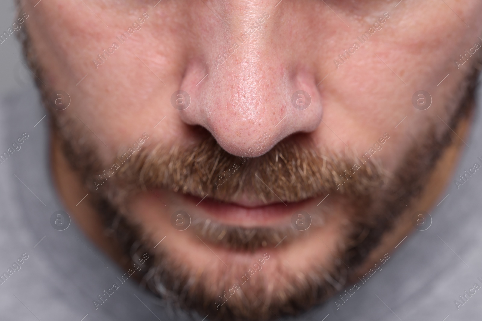 Photo of Closeup view of man with normal skin