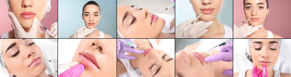 Collage with photos of woman during lip augmentation procedure. Banner design