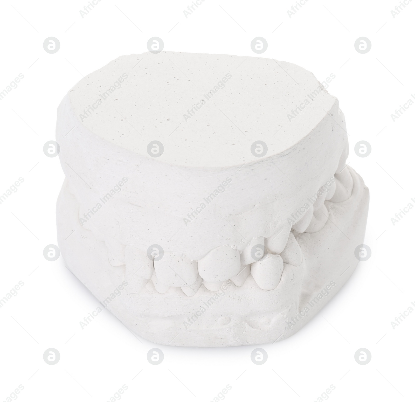 Photo of Dental model with gums isolated on white. Cast of teeth