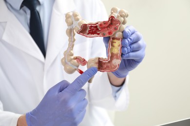 Photo of Doctor showing model of large intestine, selective focus