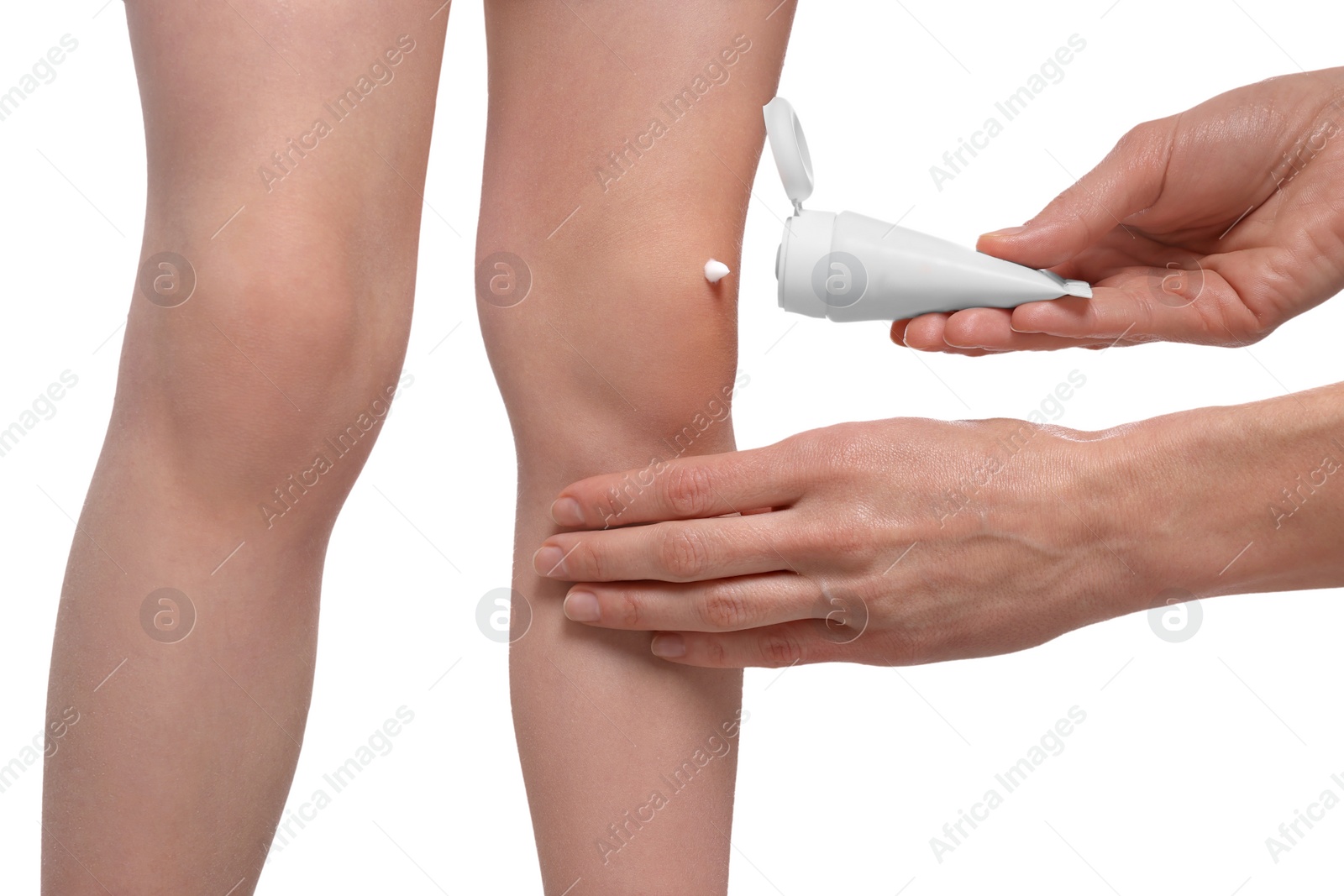 Photo of Mother applying ointment onto her daughter's knee on white background, closeup