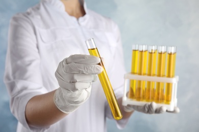 Photo of Doctor holding test tube with urine sample for analysis on light blue background, closeup