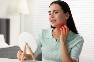 Photo of Suffering from allergy. Young woman looking in mirror and scratching her neck at white table indoors