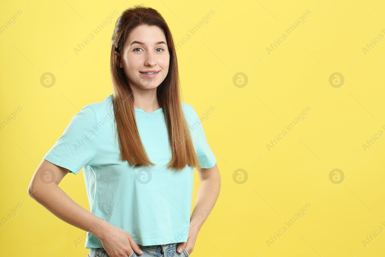 Photo of Portrait of smiling woman with dental braces on yellow background. Space for text