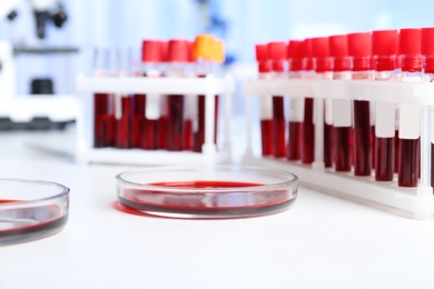 Photo of Test tubes and Petri dishes with blood samples for analysis on table in laboratory