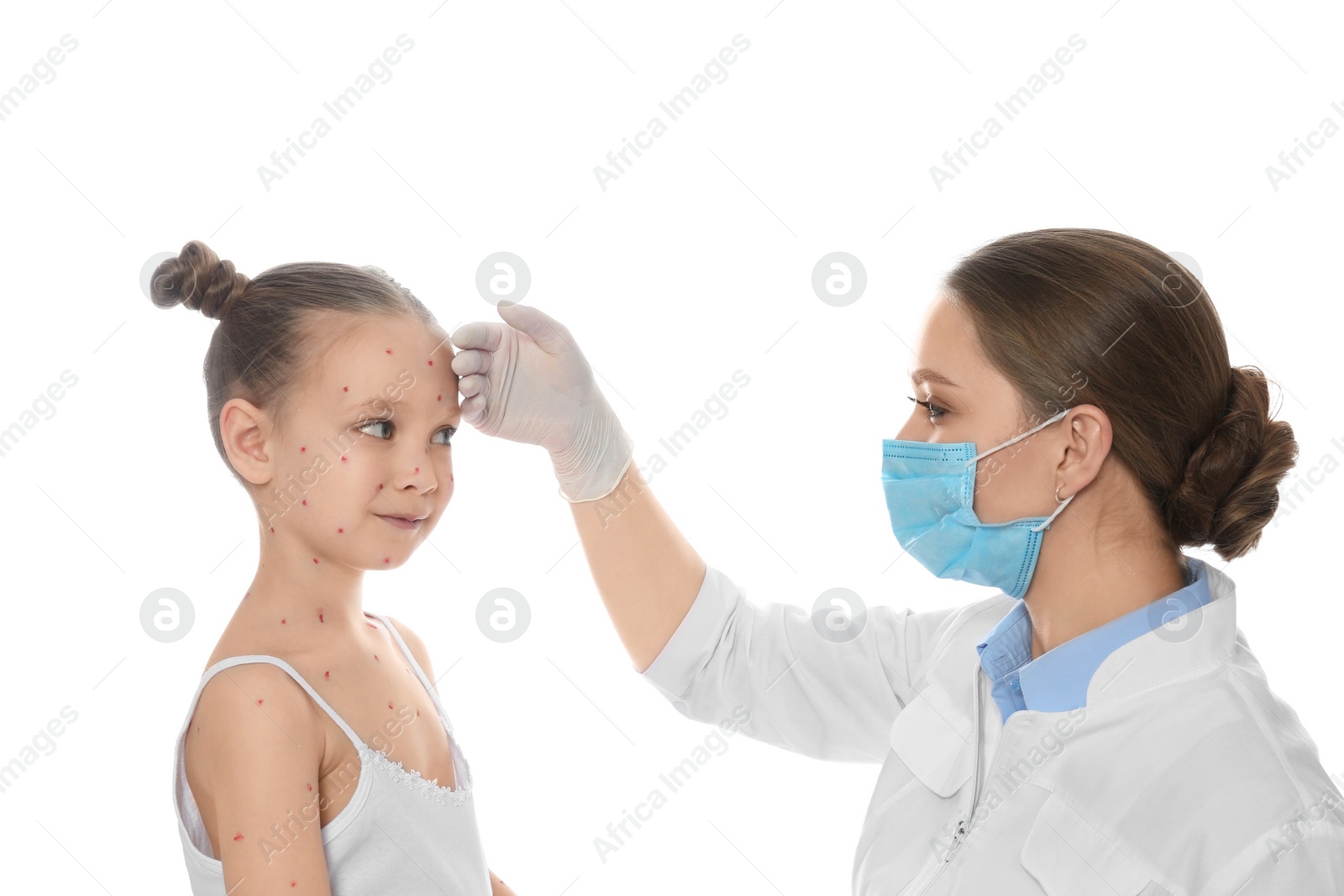 Photo of Doctor examining little girl with chickenpox on white background. Varicella zoster virus