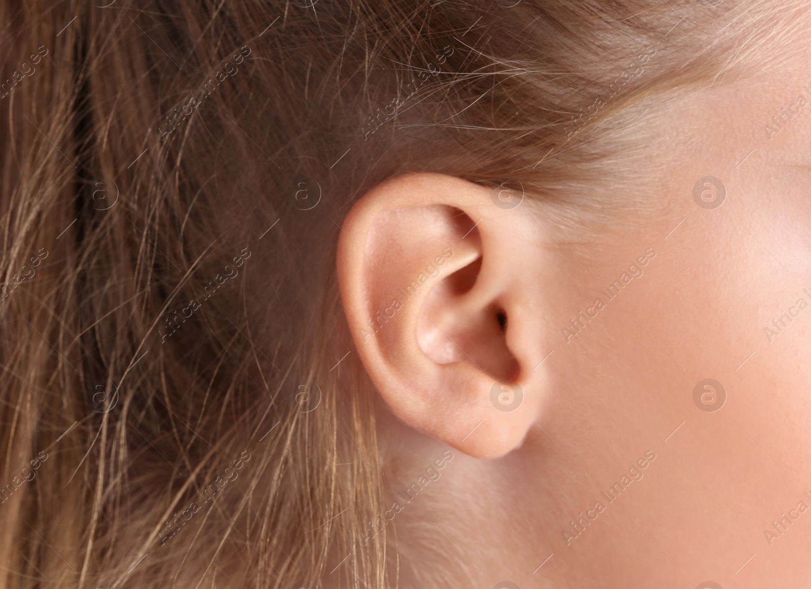 Photo of Cute little girl with hearing problem, closeup