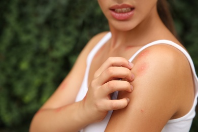 Photo of Woman scratching shoulder with insect bite outdoors, closeup