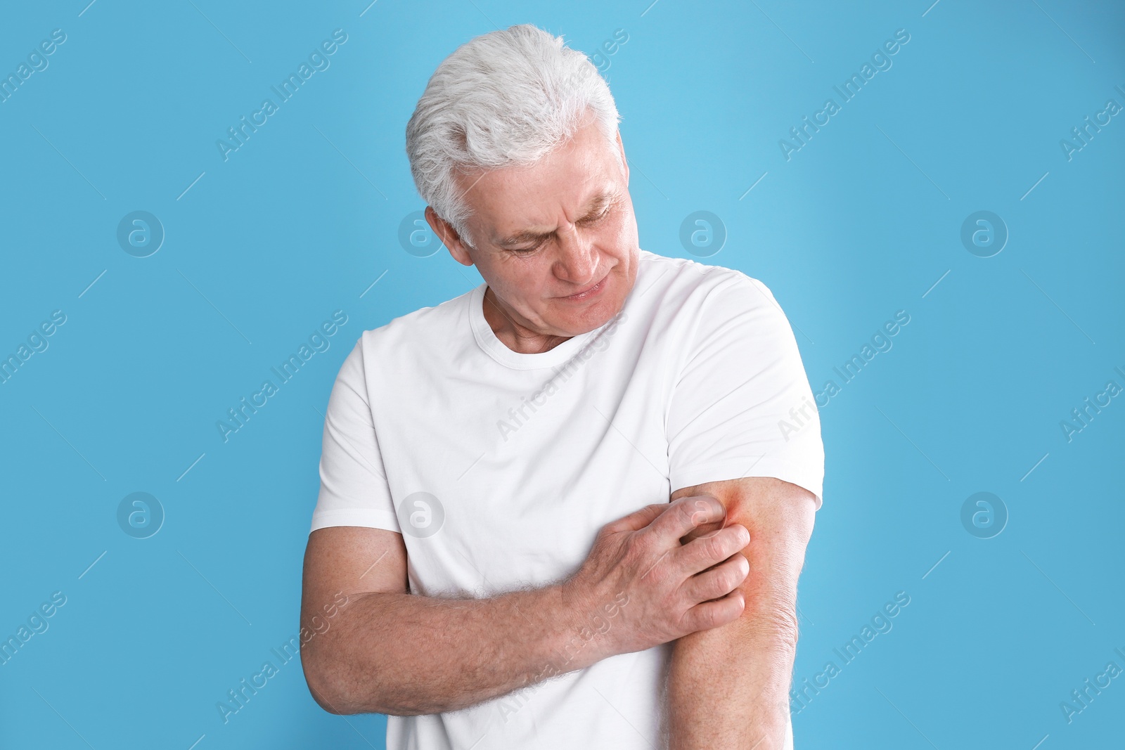 Photo of Senior man scratching arm on color background. Allergy symptom