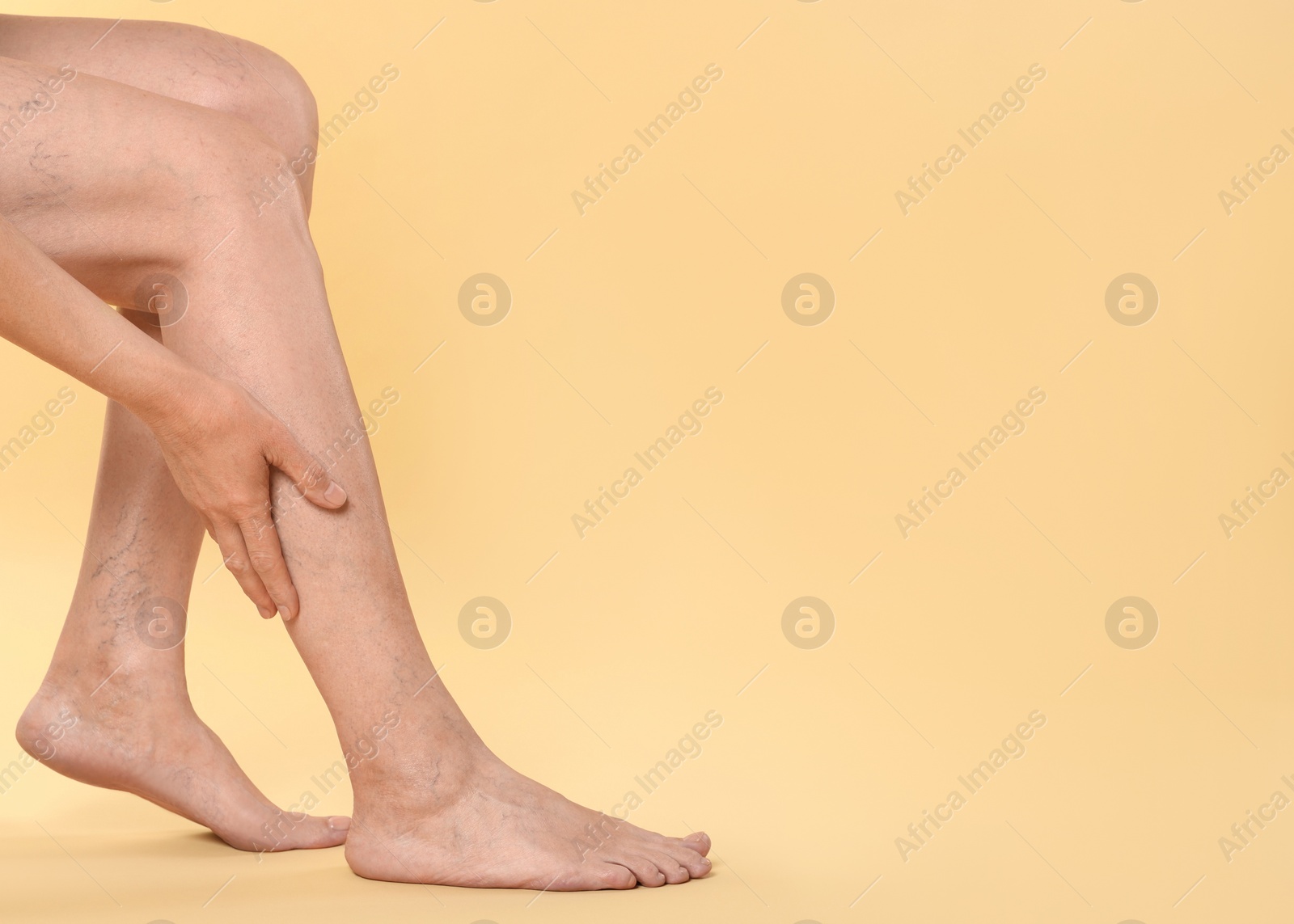 Photo of Closeup view of woman suffering from varicose veins on yellow background. Space for text