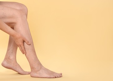 Closeup view of woman suffering from varicose veins on yellow background. Space for text