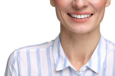 Photo of Woman with clean teeth smiling on white background, closeup