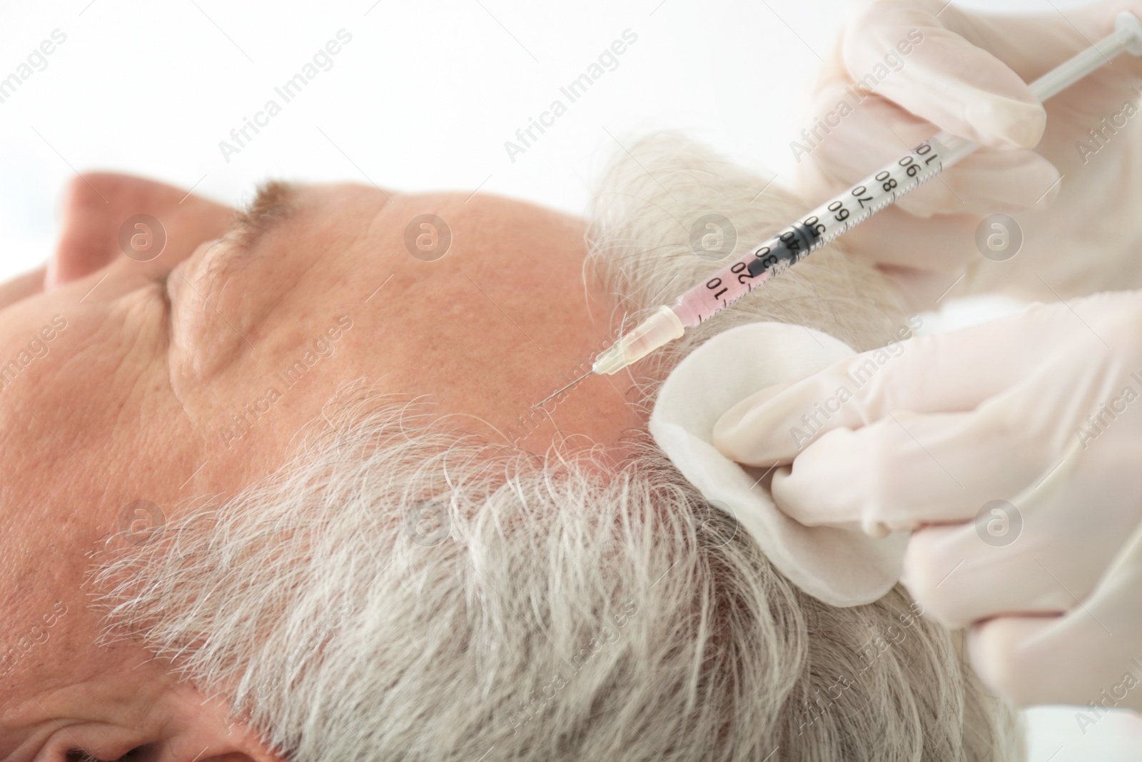 Photo of Senior man with hair loss problem receiving injection in salon, closeup