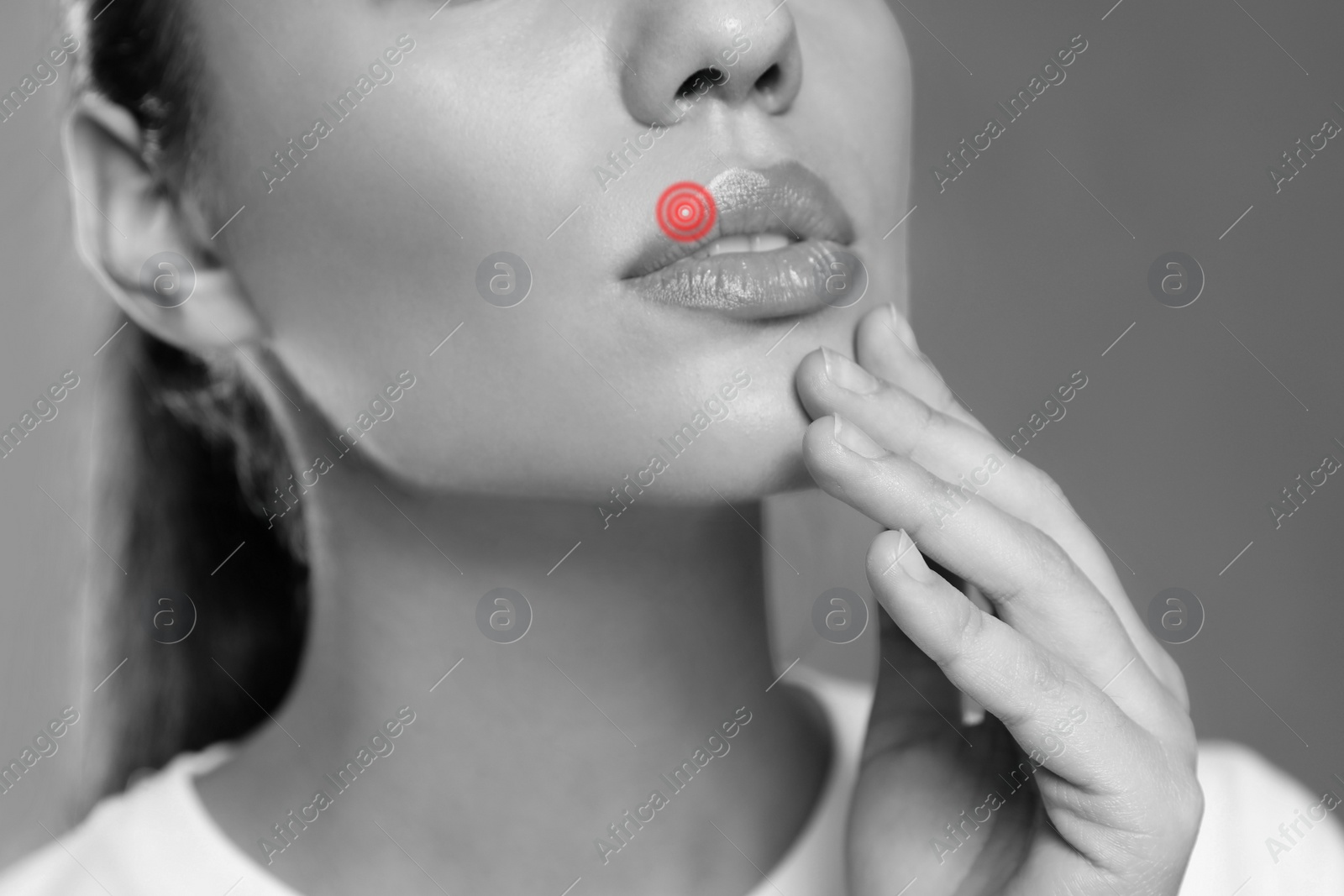 Image of Woman with herpes on lip, closeup. Black and white effect