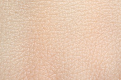 Photo of Texture of healthy skin as background, macro view