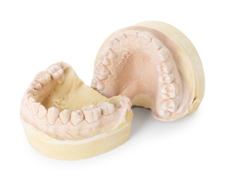 Photo of Dental model with jaws isolated on white. Cast of teeth