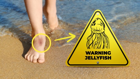 Image of Jellyfish warning sign and injured woman on beach. Banner design