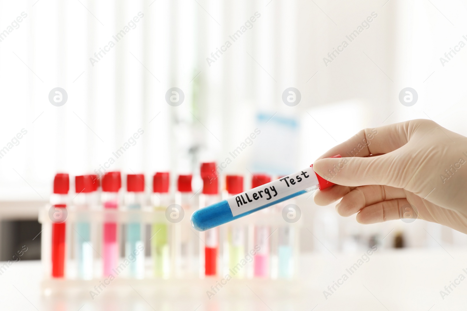 Photo of Doctor holding tube with label ALLERGY TEST over table, closeup