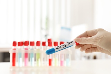 Doctor holding tube with label ALLERGY TEST over table, closeup