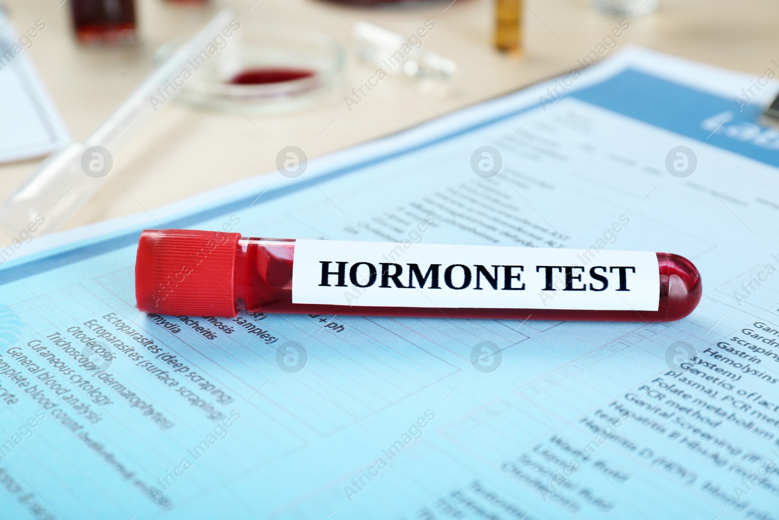 Photo of Hormone test. Sample tube with blood and laboratory form on table, closeup