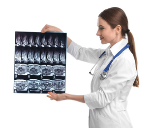 Orthopedist holding X-ray picture on white background