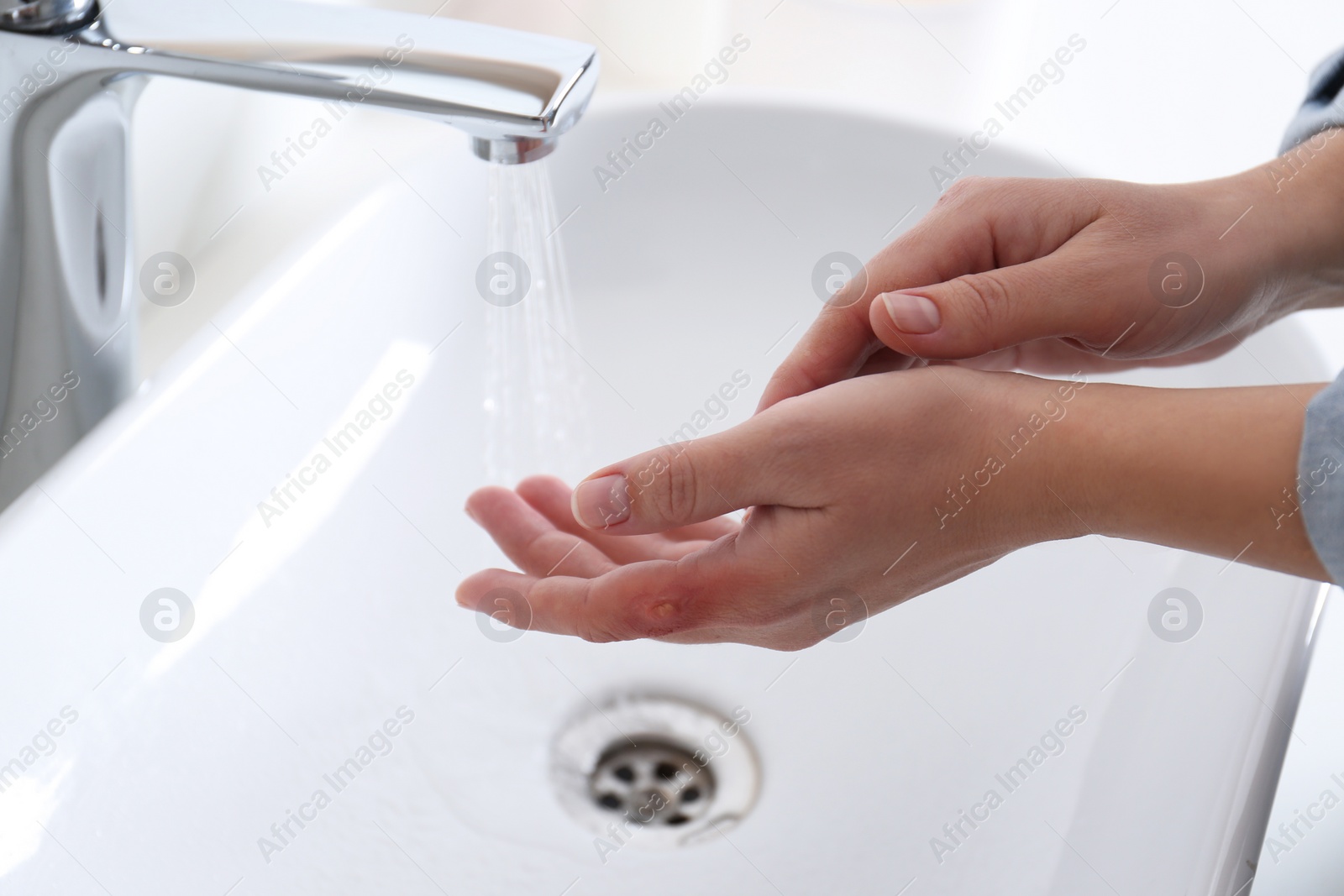 Photo of Woman putting burned hand under running cold water indoors, closeup