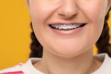 Smiling woman with dental braces on orange background, closeup