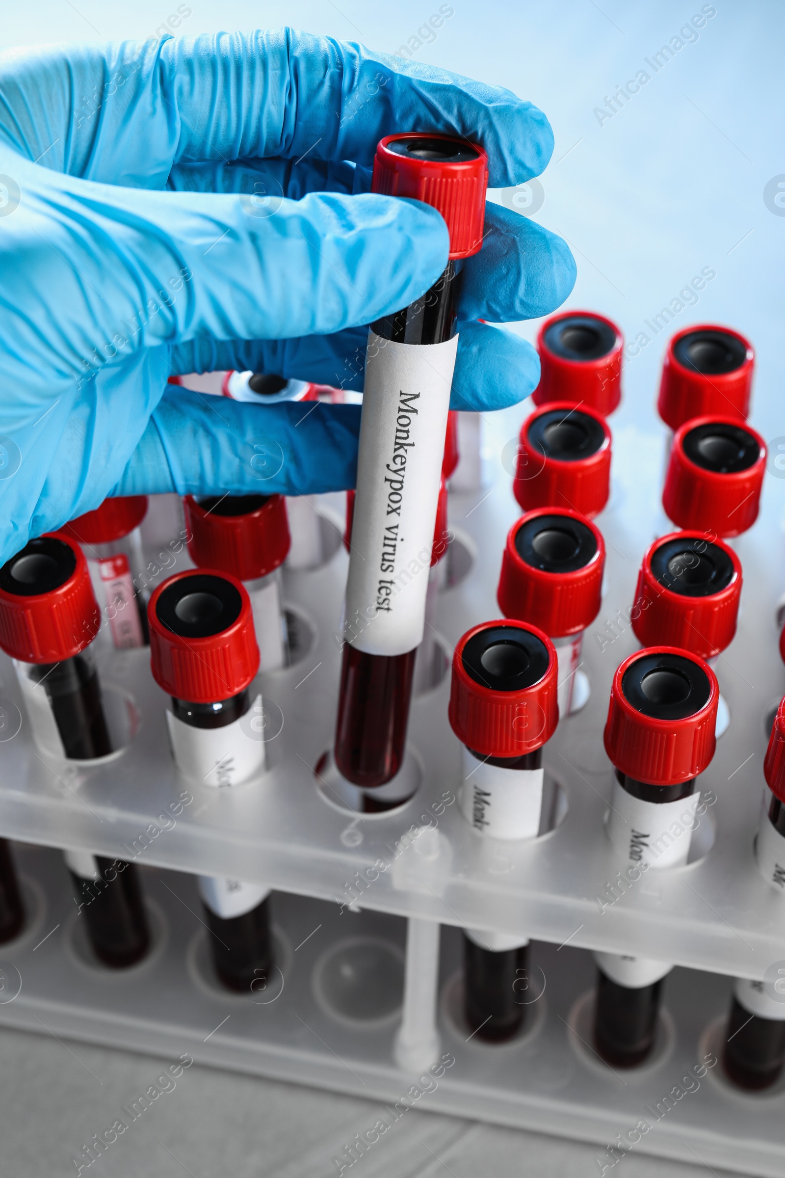 Photo of Monkeypox virus test. Laboratory worker putting sample tube with blood into rack, closeup