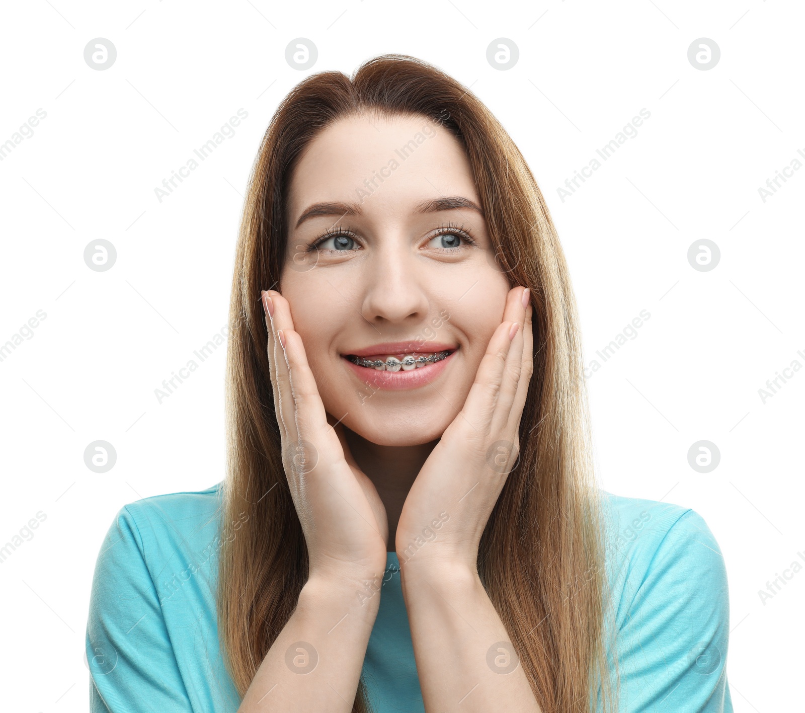 Photo of Portrait of smiling woman with dental braces on white background