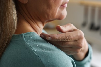 Woman brushing dandruff off her sweater indoors, closeup