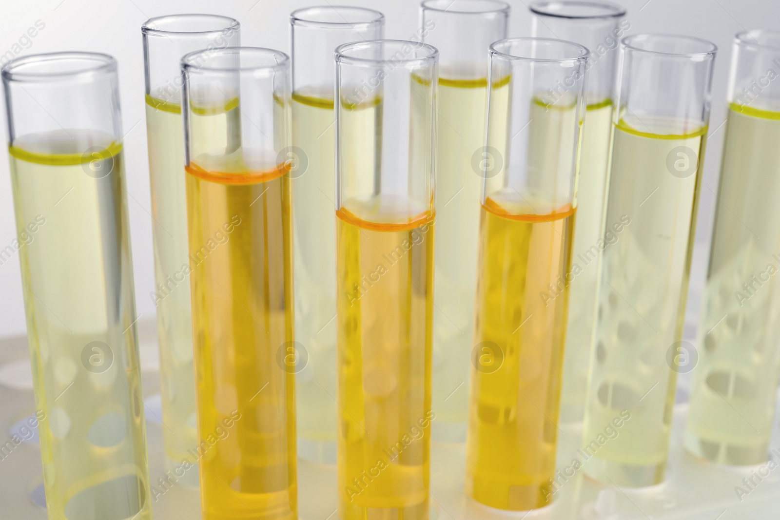 Photo of Tubes with urine samples for analysis on light grey background, closeup