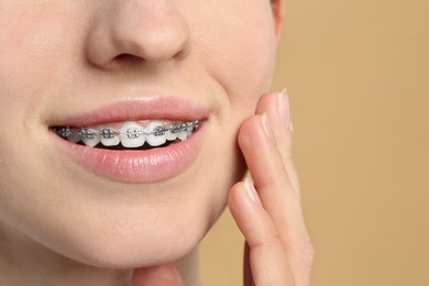 Smiling woman with dental braces on beige background, closeup. Space for text