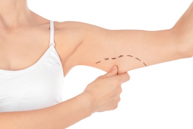 Photo of Woman with marks on arm for cosmetic surgery operation against white background, closeup