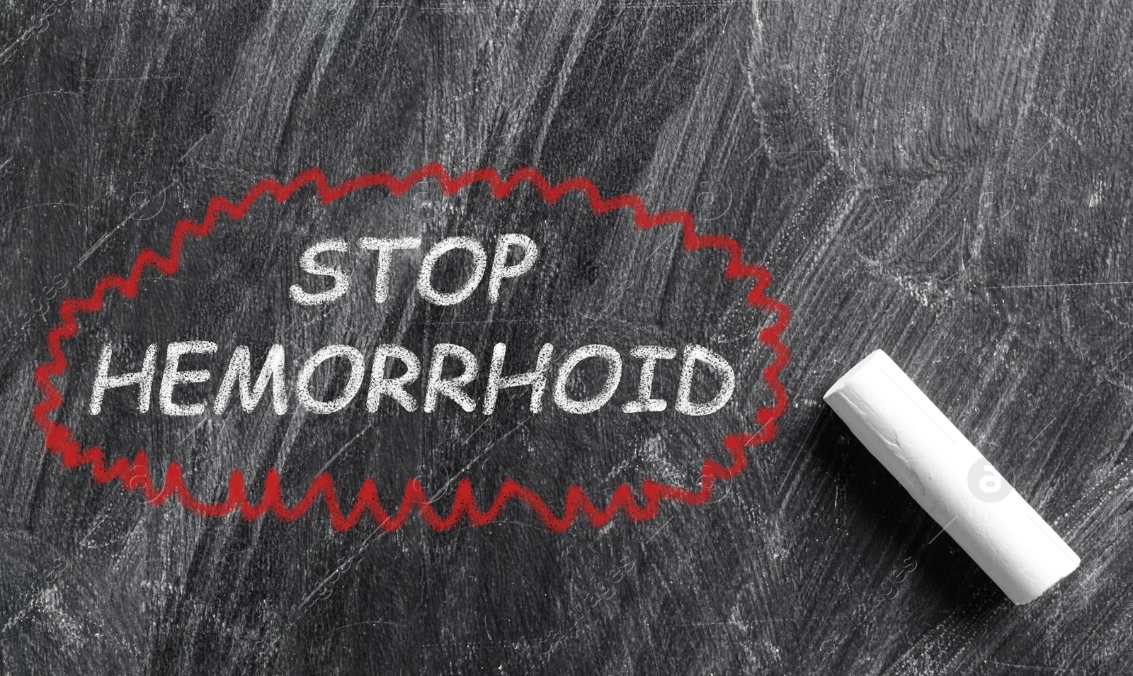 Image of Piece of white chalk and phrase Stop Hemorrhoid written on blackboard, top view