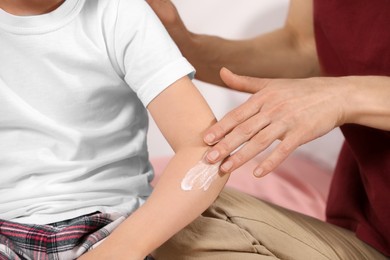 Photo of Mother applying ointment onto her daughter's arm against blurred background, closeup