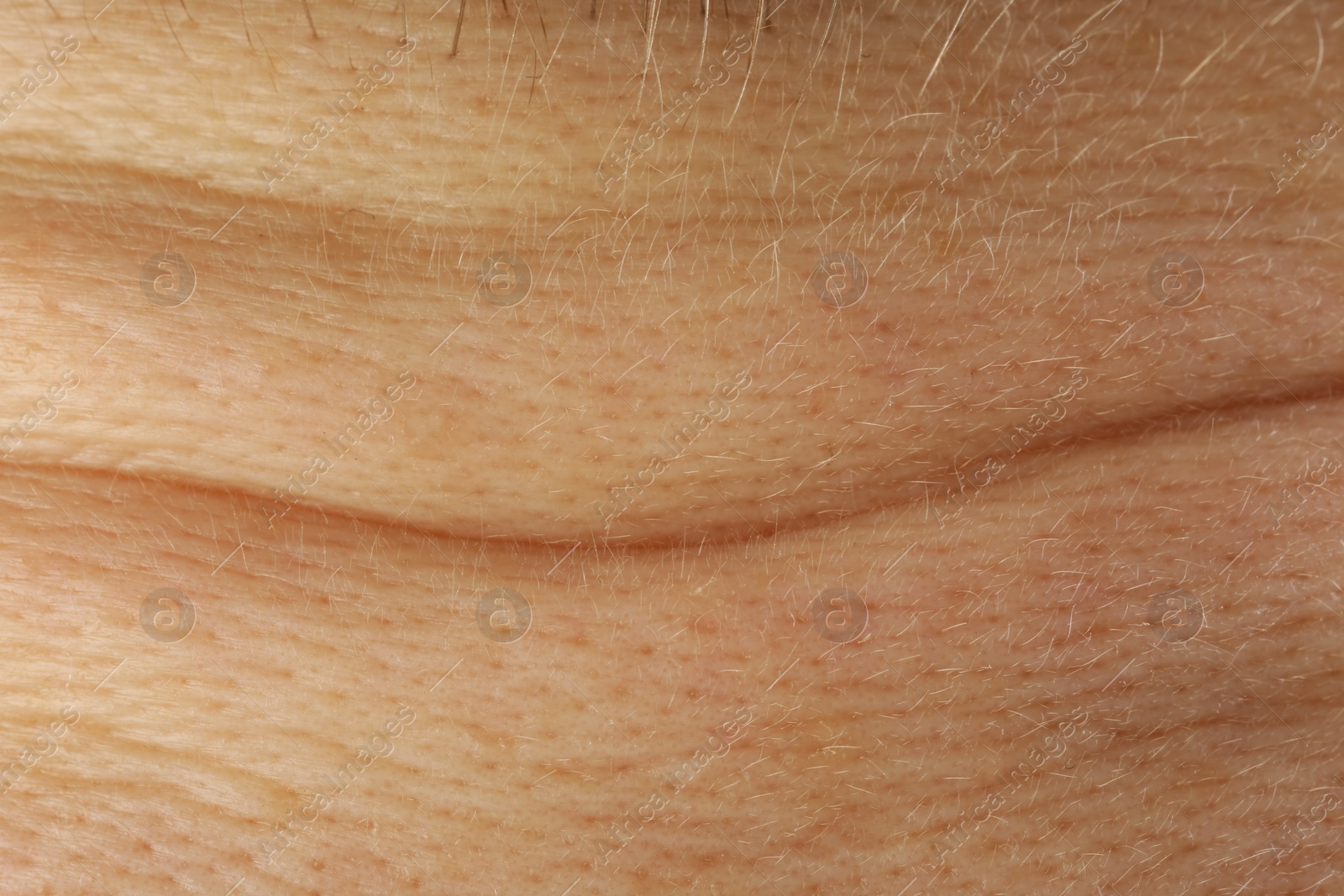 Photo of Texture of healthy skin as background, macro view