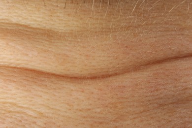 Photo of Texturehealthy skin as background, macro view