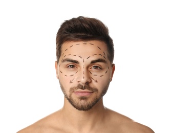 Photo of Young man with marks on face for cosmetic surgery operation against white background
