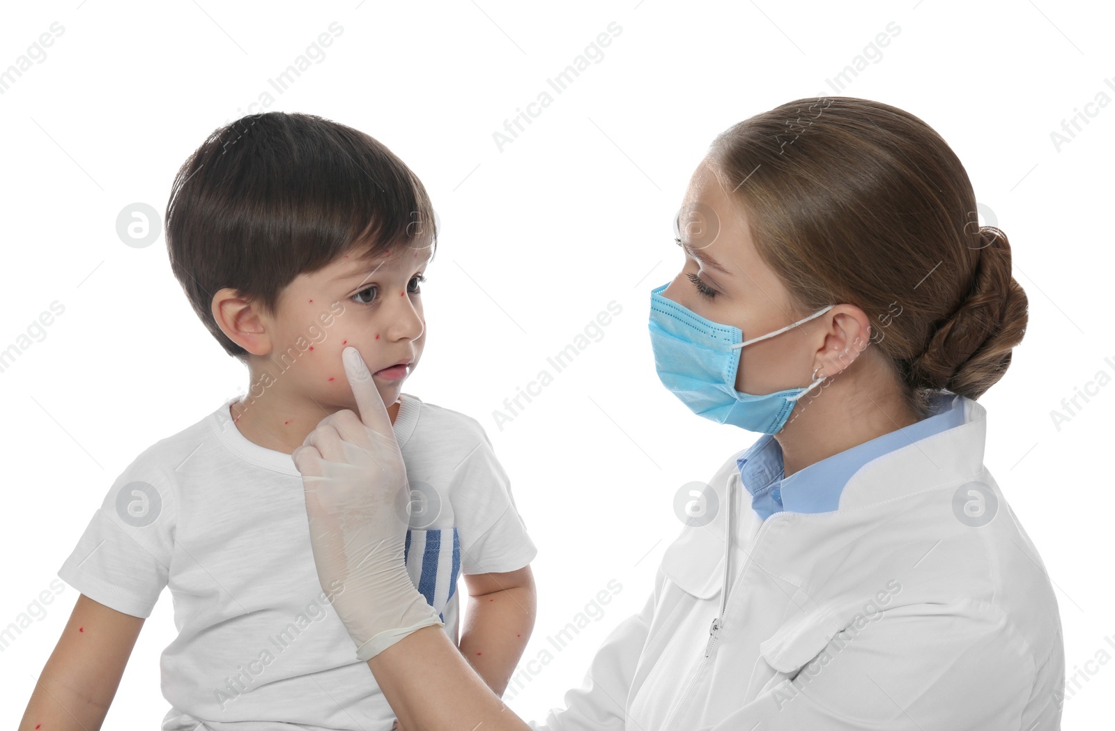 Photo of Doctor examining little boy with chickenpox on white background. Varicella zoster virus