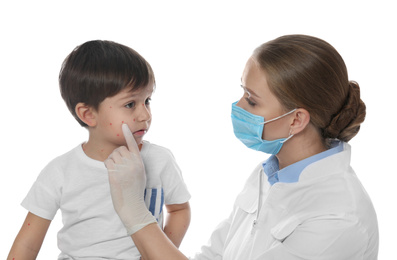 Doctor examining little boy with chickenpox on white background. Varicella zoster virus