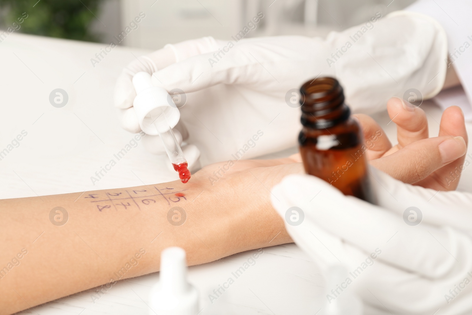 Photo of Doctor making allergy test at table, closeup