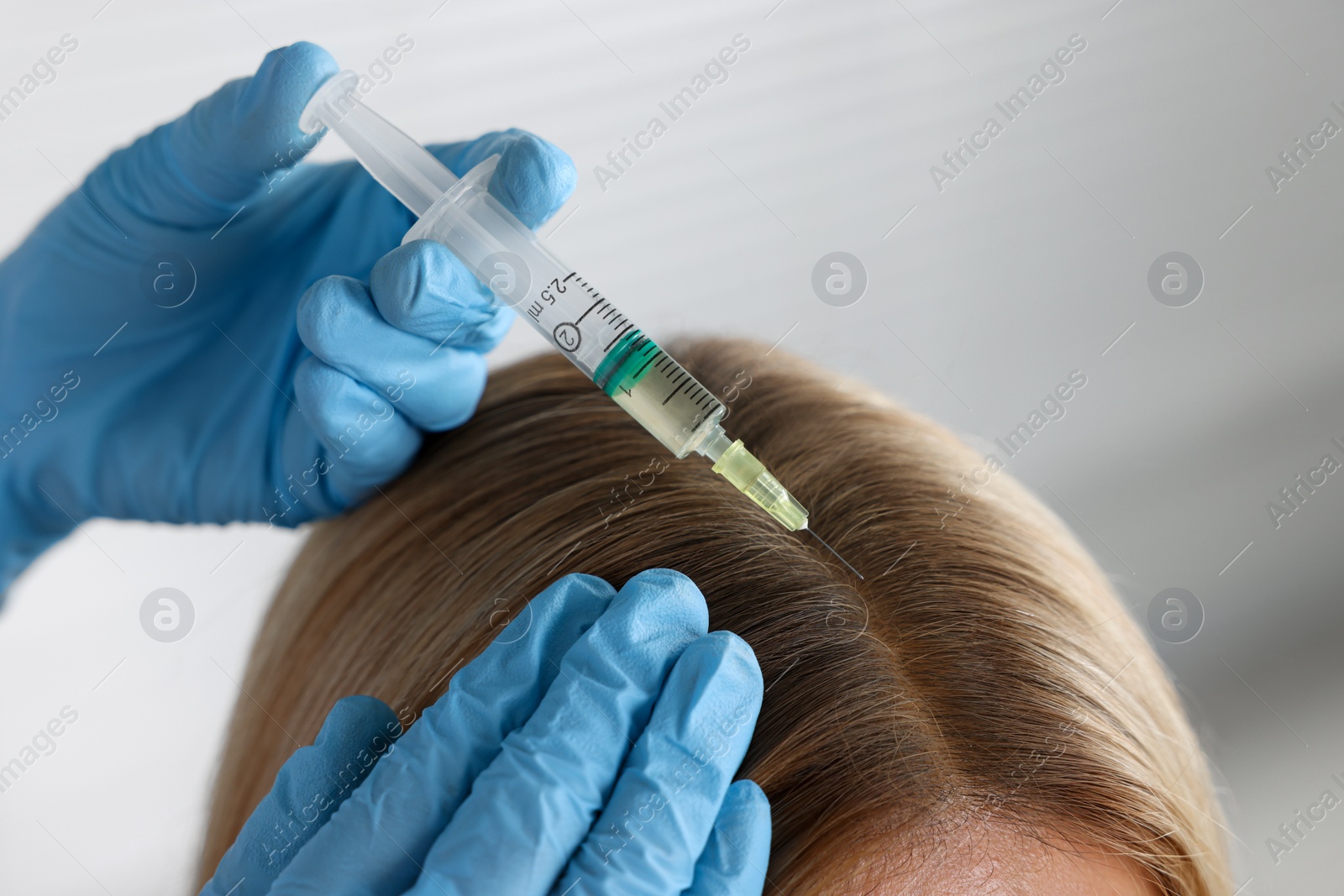 Photo of Trichologist giving injection to patient in clinic, closeup