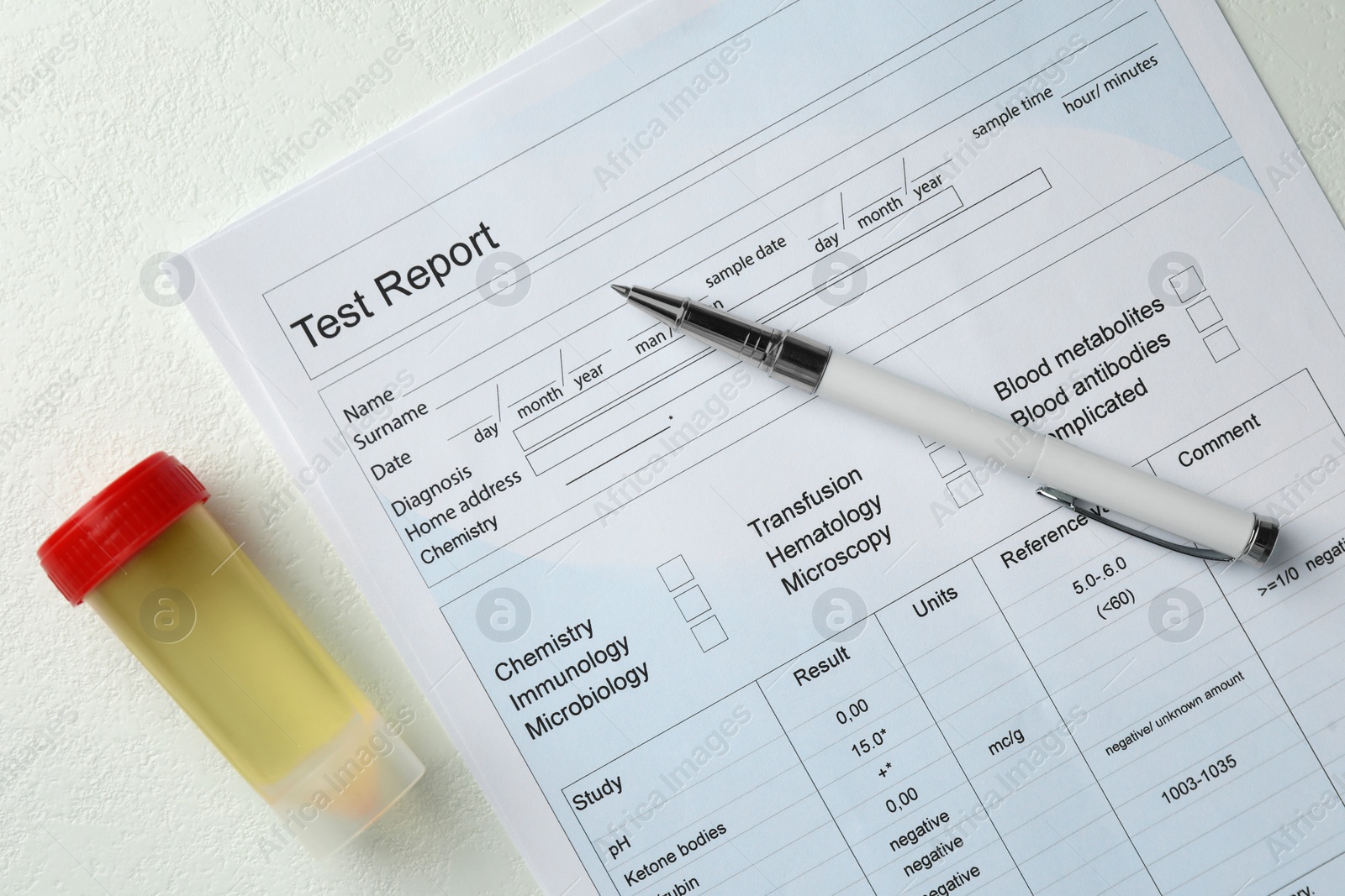 Photo of Drug test result form, container with urine sample and pen on light table, flat lay