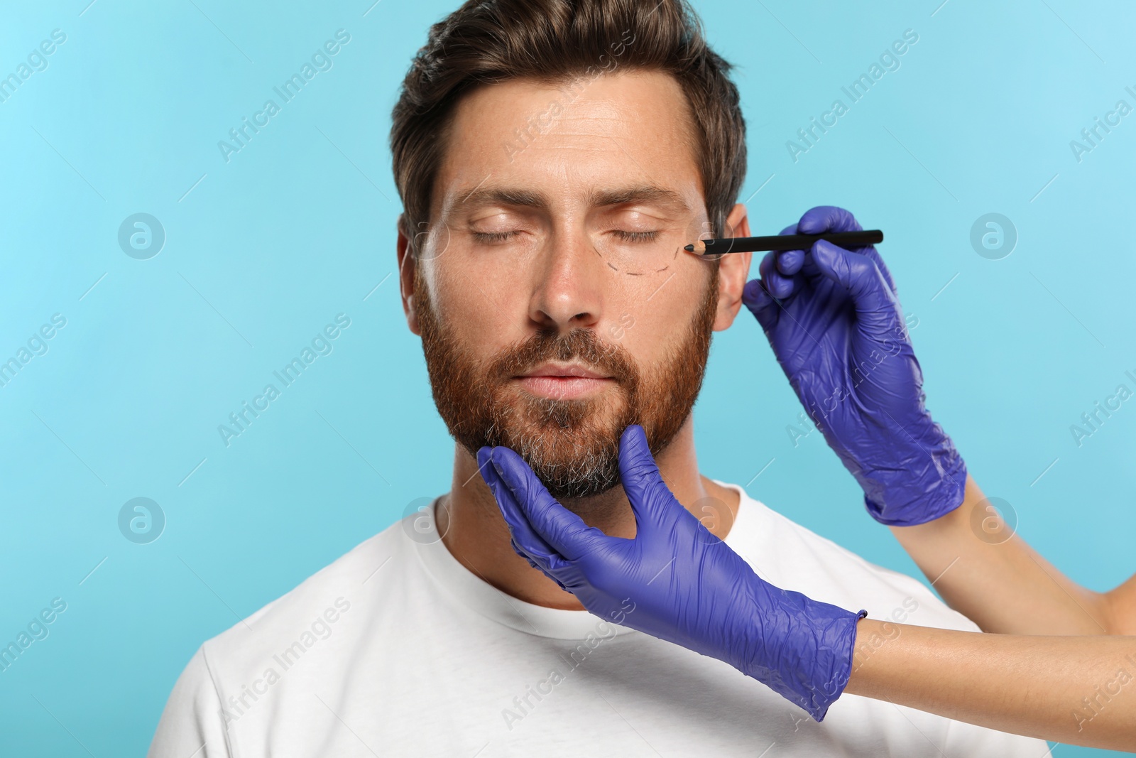 Photo of Doctor with pencil preparing patient for cosmetic surgery operation on light blue background, closeup