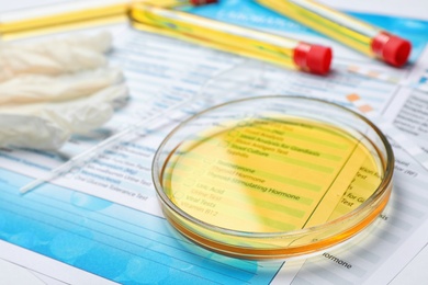 Glass dish with urine sample and test forms on table. Urology concept